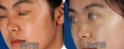 1653360591779932.png image.png