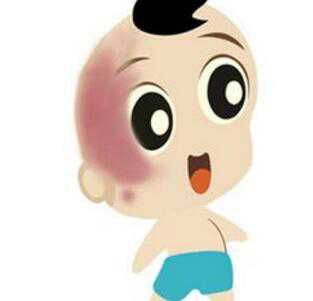 昆明协大皮肤病医院:宝宝脸上的红胎记好不好治? 昆明协大皮肤病医院:宝宝脸上的红胎记好不好治?