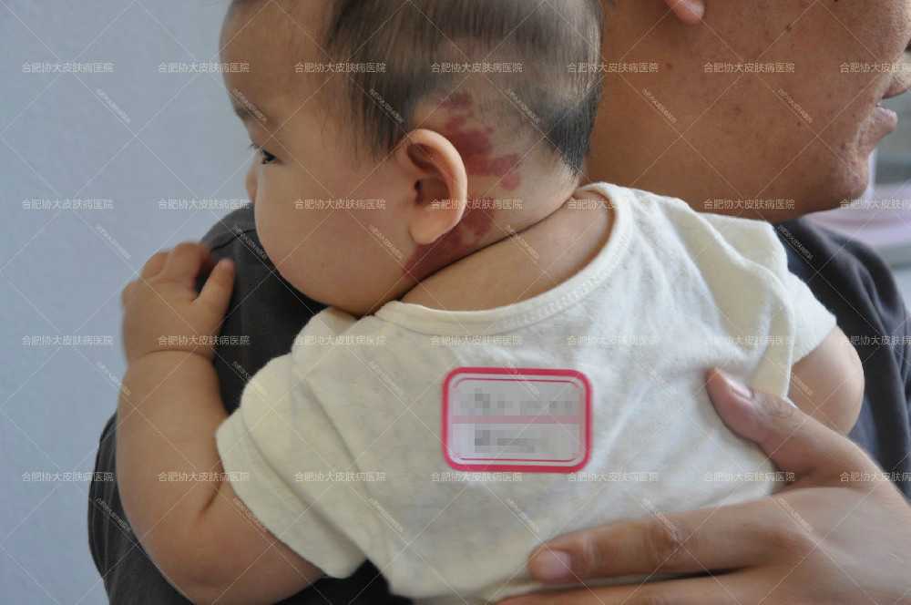 1660176745379143.jpg 1.JPG